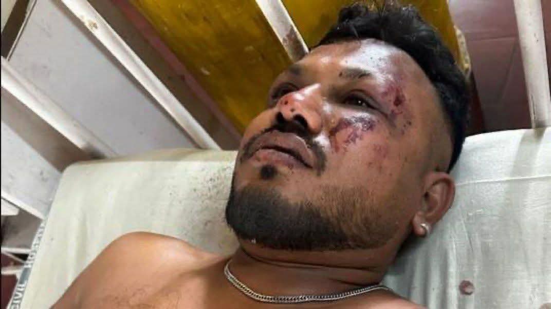 ২৪২ আরোহীর মধ্যে ভাগ্যক্রমে বেঁচে গেলেন রমেশ